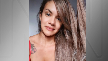 Juliana Garcia dos Santos passa por cirurgia de reconstrução facial após ser agredida em elevador
